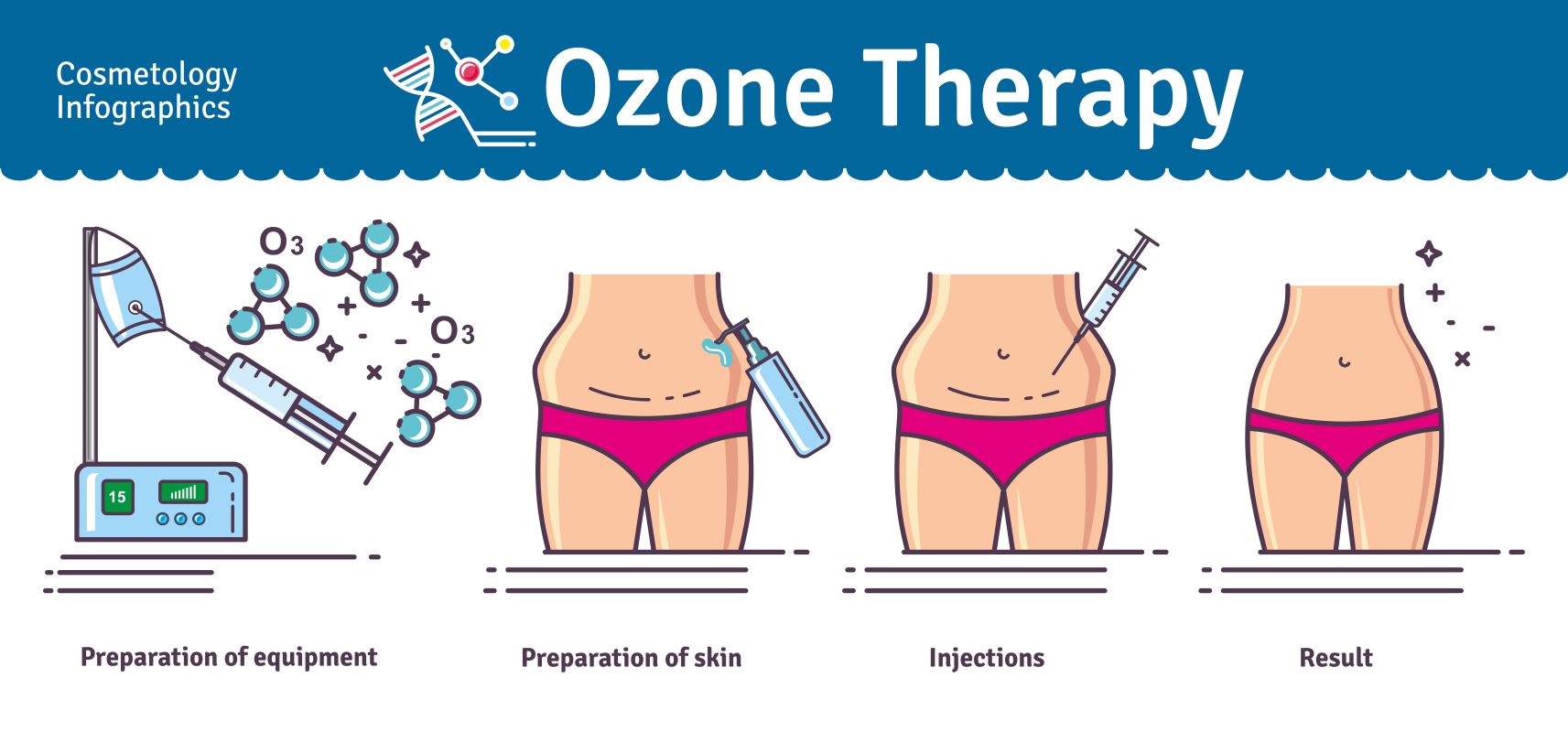 ozone for body contouring