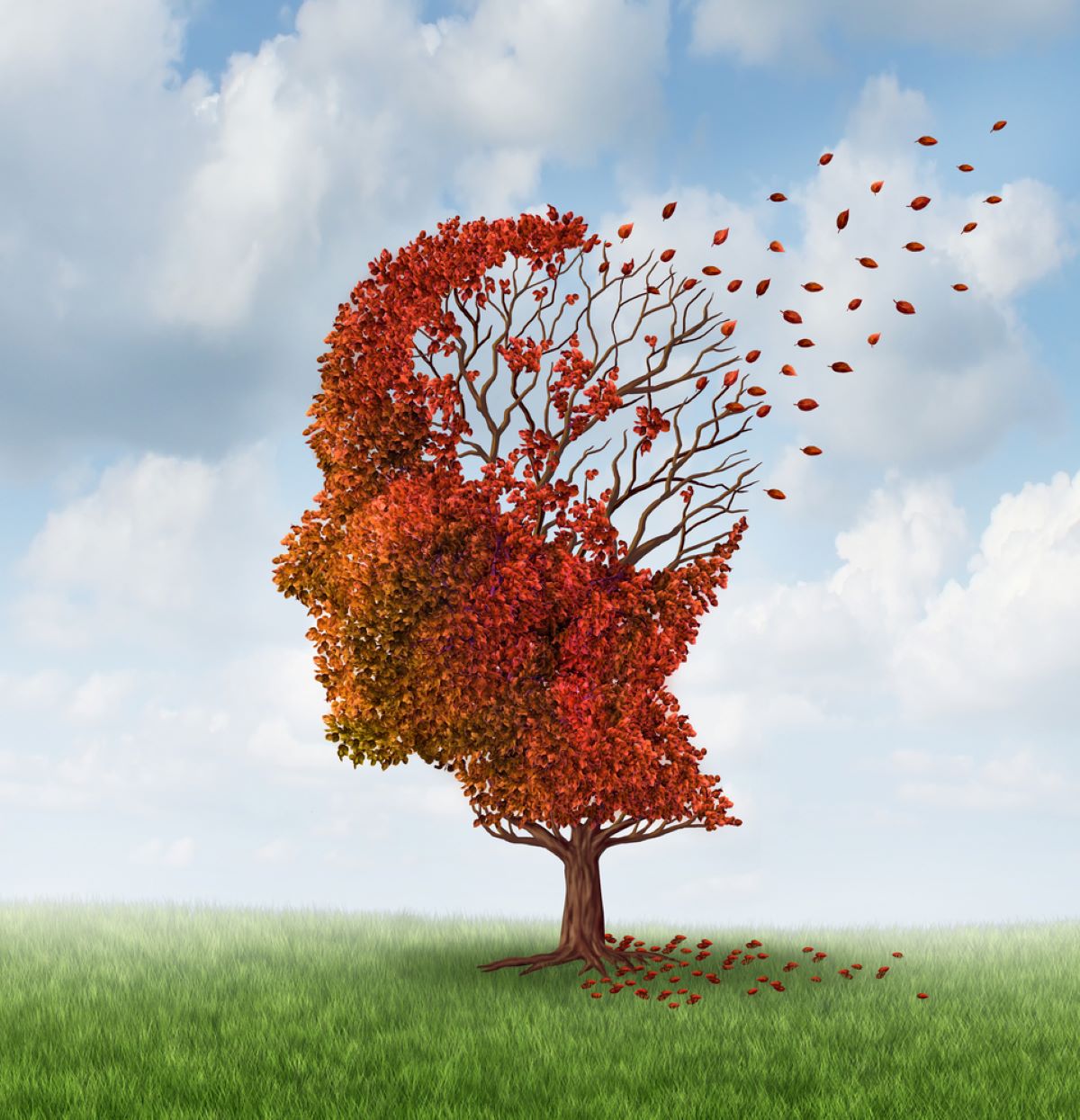 Alzheimer's brain as tree losing its leaves